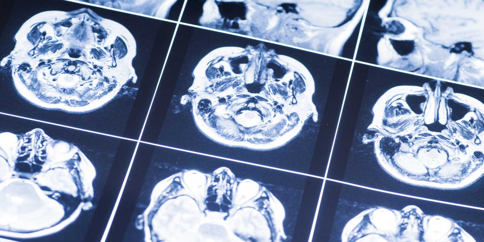 MRIs: FDA Asleep at the Wheel