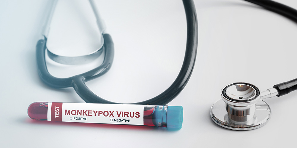 Monkeypox: A Public Health Emergency?