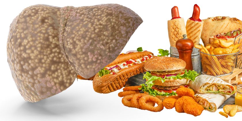 The Hidden Cost of Convenience: How Modern Food Is Fueling a Silent Liver Epidemic
