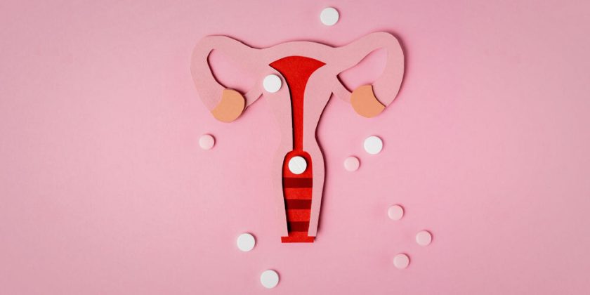 PCOS Beyond Reproduction: The Metabolic Roots of a Hormonal Disorder